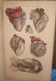 Rare John Lizars 11/12 Parts Surgical Anatomical Plates Ca.  1825 First Edition Other photo 10