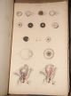 Rare John Lizars 11/12 Parts Surgical Anatomical Plates Ca.  1825 First Edition Other photo 11