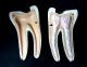 Antique Denoyer Geppert - Molar Dental Tooth Anatomical Teaching Model,  2 Parts Dentistry photo 1