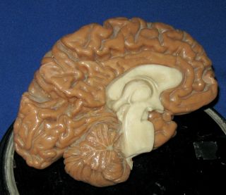 Antique 19thc Victorian Large Wax Anatomical Model Of Human Brain Plinth Mounted photo