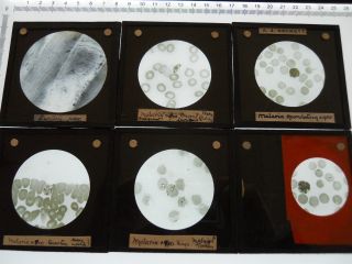 Magic Lantern Microscope Slide Photos Antique Malaria Scientific Glass Plate 1 photo