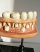 Antique Anotomical Model Of The Human Jaw.  19th Century.  Very Large.  Great Fun Other photo 1