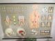 Vintage Anatomical Pull Down School Chart Of Teeth / Dentist Other photo 1