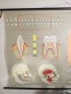 Vintage Anatomical Pull Down School Chart Of Teeth / Dentist Other photo 2