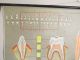 Vintage Anatomical Pull Down School Chart Of Teeth / Dentist Other photo 4