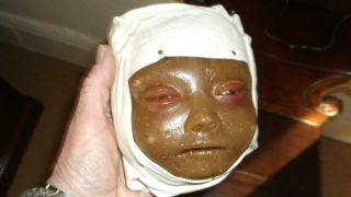 Very Rare Antique Anatomical Medical Museum Wax Baby ' S Head Moulage Glass Eyes photo