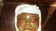 Very Rare Antique Anatomical Medical Museum Wax Baby ' S Head Moulage Glass Eyes Other Antique Science, Medical photo 1