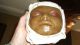 Very Rare Antique Anatomical Medical Museum Wax Baby ' S Head Moulage Glass Eyes Other Antique Science, Medical photo 2