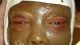 Very Rare Antique Anatomical Medical Museum Wax Baby ' S Head Moulage Glass Eyes Other Antique Science, Medical photo 4