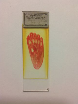 Antique Microscope Slide Of Foetal Foot,  Made By A.  C.  Cole,  1880 photo