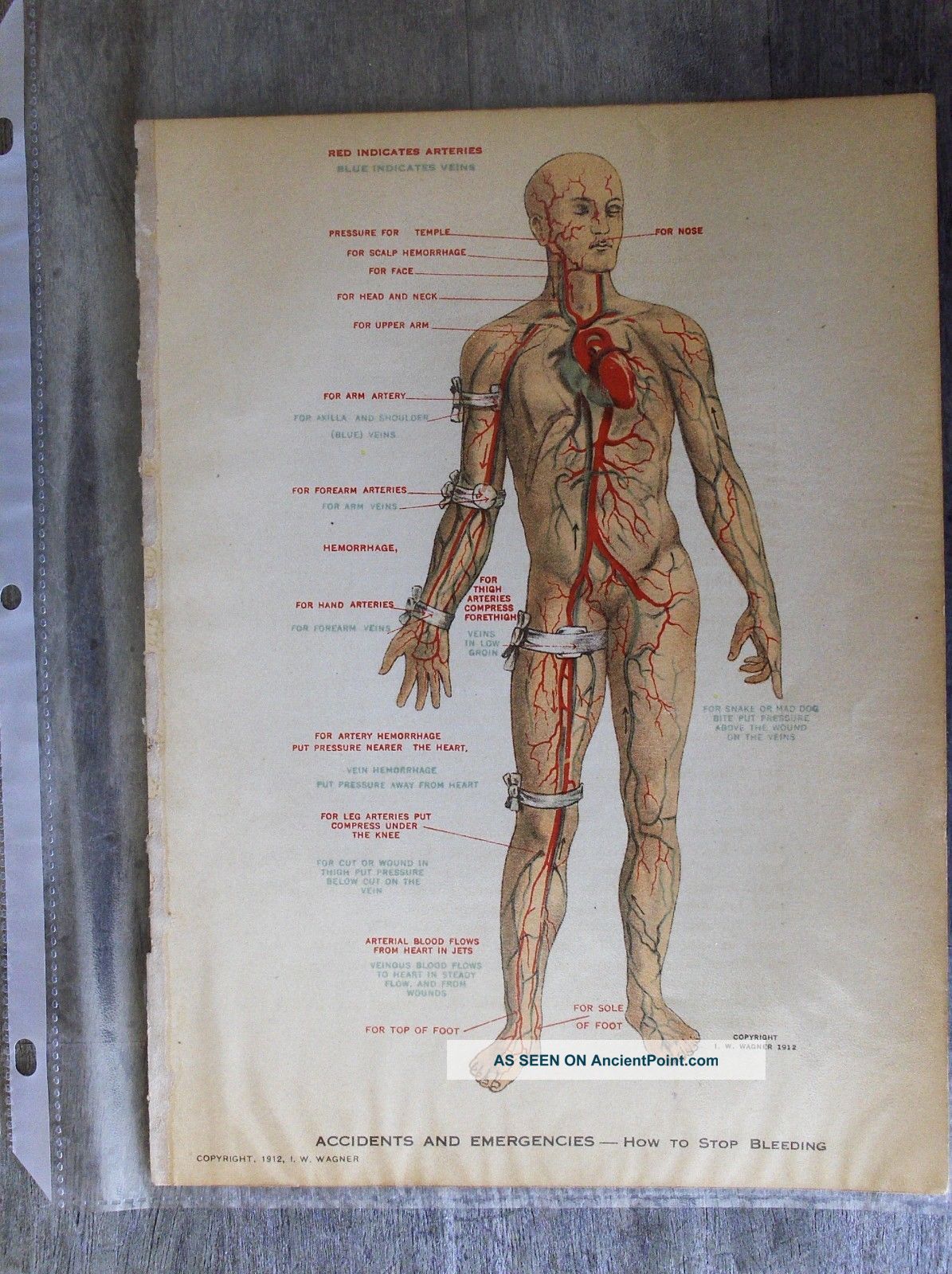 1912 Wagner Litho Print Medical Art - Accidents & Stopping Bleeding Quack Medicine photo