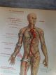 1912 Wagner Litho Print Medical Art - Accidents & Stopping Bleeding Quack Medicine photo 3