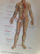 1912 Wagner Litho Print Medical Art - Accidents & Stopping Bleeding Quack Medicine photo 4