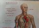 1912 Wagner Litho Print Medical Art - Accidents & Stopping Bleeding Quack Medicine photo 5