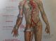 1912 Wagner Litho Print Medical Art - Accidents & Stopping Bleeding Quack Medicine photo 6