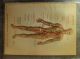 1912 Wagner Litho Print Medical Art - Accidents & Stopping Bleeding Quack Medicine photo 8
