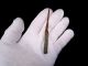 Very Rare Roman Medical Iron Tool W/ Bronze Handle, Roman photo 4