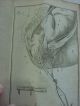 1797 Theoretische Unleitung Geburtshulfe Obstetrics Medicine Illustrated Other Medical Antiques photo 11