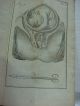 1797 Theoretische Unleitung Geburtshulfe Obstetrics Medicine Illustrated Other Medical Antiques photo 5