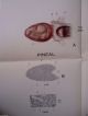 Life Size Frohse Medical Chart Plate 9 The Endocrine Glands Anatomy Poster Other Medical Antiques photo 1