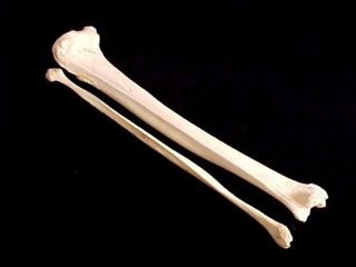Antique Real Human Leg Bones Authentic Anatomical Model For Medical Study B photo