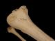Antique Real Human Leg Bones Authentic Anatomical Model For Medical Study B Other Medical Antiques photo 1