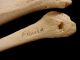 Antique Real Human Leg Bones Authentic Anatomical Model For Medical Study B Other Medical Antiques photo 2