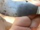 Amputee Knife & Fork - J.  Russell & Co.  Green River Works1 Other Medical Antiques photo 1