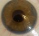 Old German Human Glasseye Prosthetic Vintage Antique Ww2 Glass Eye No.  4 Other Medical Antiques photo 2