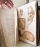 An Atlas Of Illustrations Of Pathology 1877 Folio W/color Plates Very Scarce Other Medical Antiques photo 2