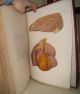 An Atlas Of Illustrations Of Pathology 1877 Folio W/color Plates Very Scarce Other Medical Antiques photo 3