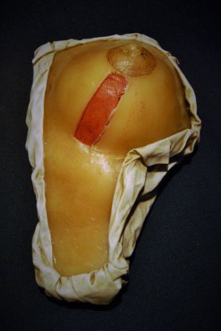 Wax Dissected Breast Anatomy Model In (curio Item) photo