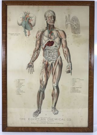 Antique The Egyptian Chemical Co Practical Embalming Framed Picture Anatomy photo