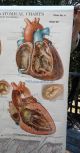 Antique Frohse Anatomical Chart No.  4 Schema - Circulation Heart - Skin 1918 Nystrom Other Medical Antiques photo 6