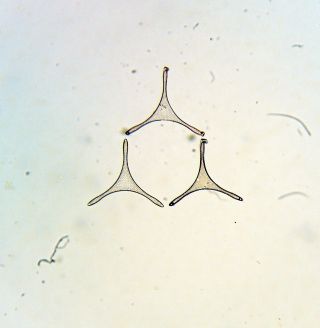 Pair Diatom Microscope Slides By Cole & Watson photo