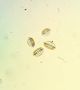 Pair Diatom Microscope Slides By Cole & Watson Other Antique Science Equip photo 2