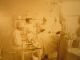 Early Photo Operating Room W Doctors Nurses Patient & Anesthesiologist Mk Frshnr Other Medical Antiques photo 2